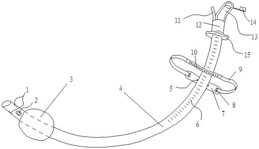西山科技获得实用新型专利授权：“缝合器及外管组件”