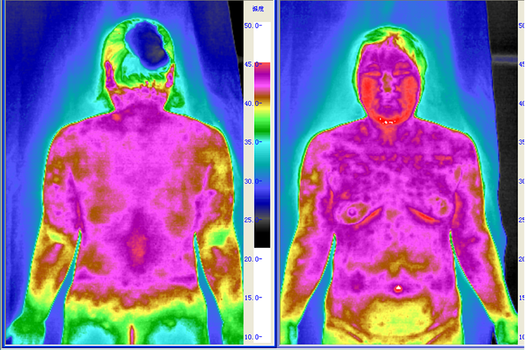 天智航获得实用新型专利授权：“X光成像系统”