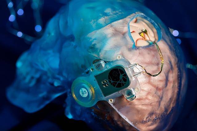 为意念装上现实“臂膀” 脑机接口助力“心想”到“事成”