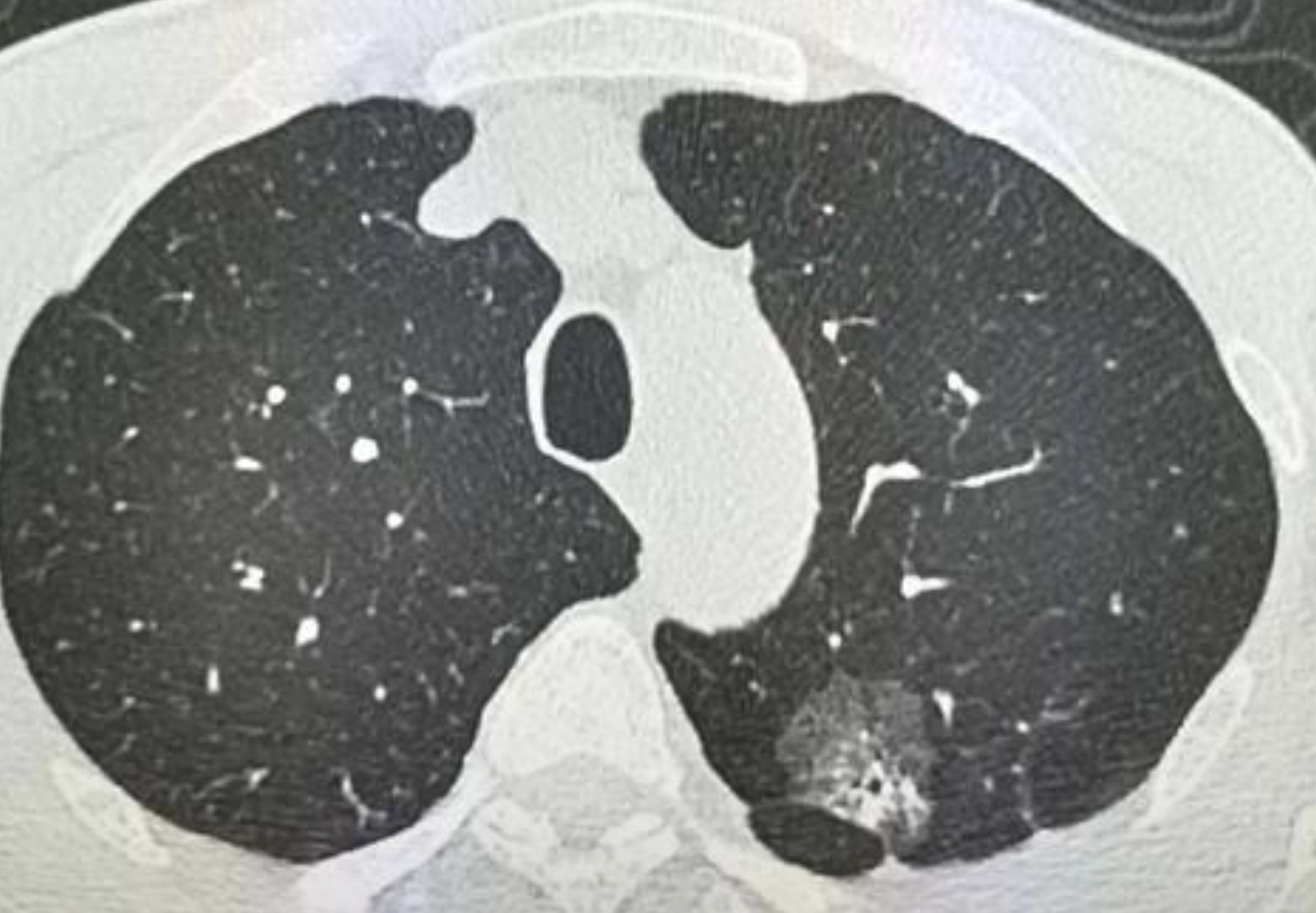 鞍钢股份公布国际专利申请：“一种具有高CTOD特性的51kg级BCA2止裂钢及其制造方法”